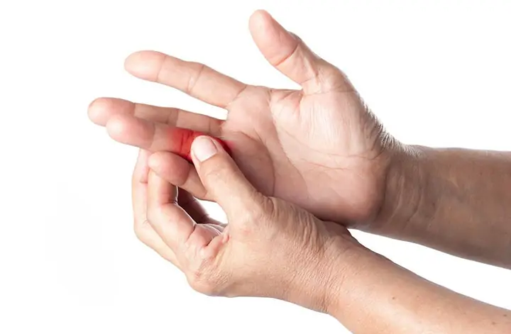 Nhận Biết Và Điều Trị Đau Khớp Ngón Tay Đeo Nhẫn: Nguyên Nhân, Dấu Hiệu Và Cách Cải Thiện