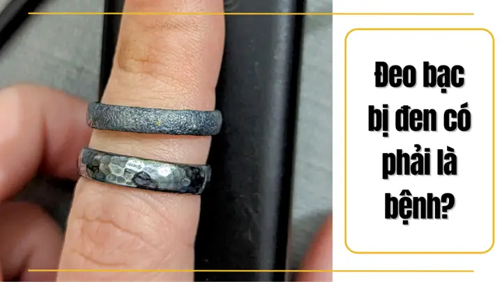 Nguyên Nhân Đeo Nhẫn Bạc Bị Đen Và Cách Khắc Phục Hiệu Quả Cho Người Dùng