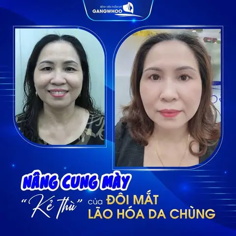 Giải Mã Điềm Báo Giật Chân Mày: Ý Nghĩa Tốt Xấu Theo Giờ, Trái Phải Và Giới Tính Giải Mã Điềm Báo Giật Chân Mày: Ý Nghĩa Tốt Xấu Theo Giờ, Trái Phải Và Giới Tính