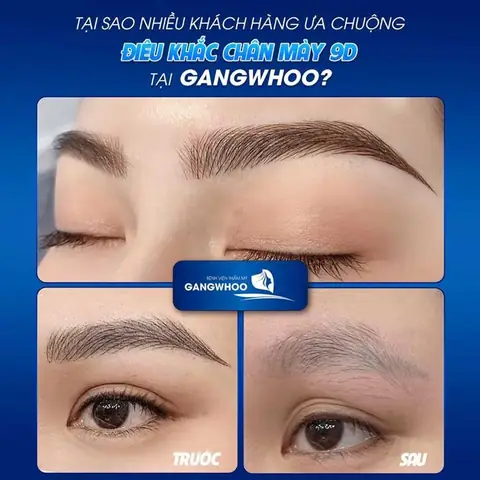 Giải Mã Điềm Báo Giật Chân Mày: Ý Nghĩa Tốt Xấu Theo Giờ, Trái Phải Và Giới Tính Giải Mã Điềm Báo Giật Chân Mày: Ý Nghĩa Tốt Xấu Theo Giờ, Trái Phải Và Giới Tính
