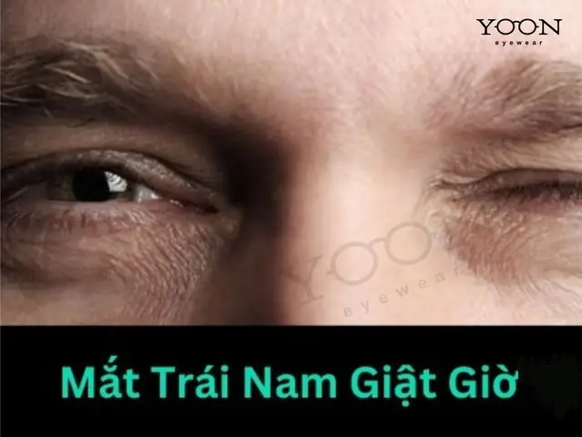Giải Mã Điềm Báo Giật Mắt Trái Nam Theo Giờ: Hên Hay Xui?