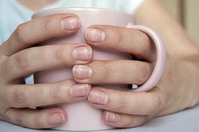Giải Mã Điềm Báo Móng Chân: Từ Dấu Hiệu Sức Khỏe Đến Ý Nghĩa Tâm Linh Giải Mã Điềm Báo Móng Chân: Từ Dấu Hiệu Sức Khỏe Đến Ý Nghĩa Tâm Linh