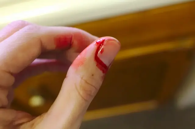 Giải Mã Điềm Báo Đứt Tay Ngón Danh Phải: Ý Nghĩa Tâm Linh Tốt Hay Xấu?