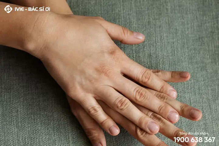 Giải Đáp Gạch Đen Nhỏ Ở Móng Tay Là Bệnh Gì Và Ý Nghĩa Cảnh Báo Sức Khỏe Giải Đáp Gạch Đen Nhỏ Ở Móng Tay Là Bệnh Gì Và Ý Nghĩa Cảnh Báo Sức Khỏe