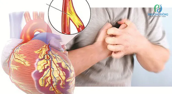 Xem Hình Ảnh Và Các Đặc Điểm Ngoại Hình (meronymy) Của Bệnh Turner Ở Trẻ Em Gái