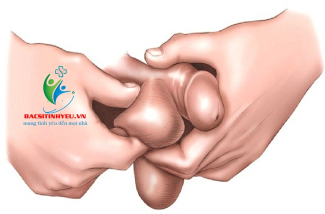 Hình Ảnh Bộ Phận Sinh Dục Nam Giới: Cấu Trúc Chi Tiết, Chức Năng & Thông Tin Y Khoa Dành Cho Người Truy Cập Hình Ảnh Bộ Phận Sinh Dục Nam Giới: Cấu Trúc Chi Tiết, Chức Năng & Thông Tin Y Khoa Dành Cho Người Truy Cập