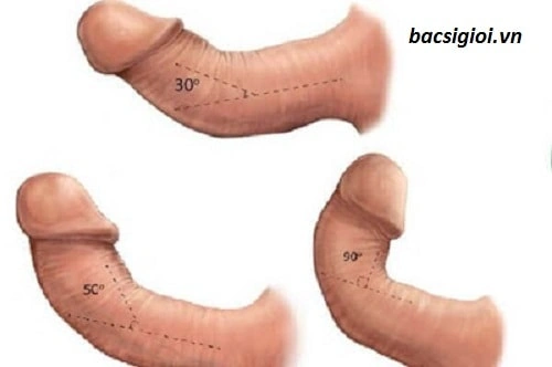 Hình Ảnh Bộ Phận Sinh Dục Nam Giới: Cấu Trúc Chi Tiết, Chức Năng & Thông Tin Y Khoa Dành Cho Người Truy Cập Hình Ảnh Bộ Phận Sinh Dục Nam Giới: Cấu Trúc Chi Tiết, Chức Năng & Thông Tin Y Khoa Dành Cho Người Truy Cập