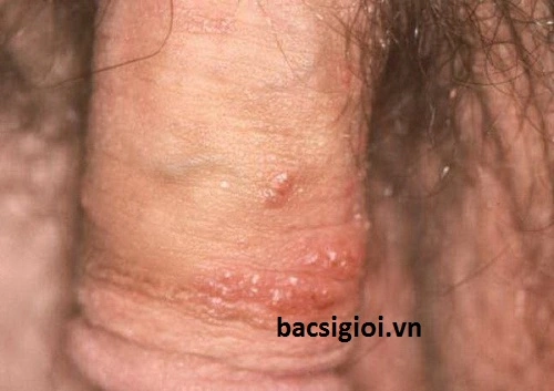 Hình Ảnh Bộ Phận Sinh Dục Nam Giới: Cấu Trúc Chi Tiết, Chức Năng & Thông Tin Y Khoa Dành Cho Người Truy Cập Hình Ảnh Bộ Phận Sinh Dục Nam Giới: Cấu Trúc Chi Tiết, Chức Năng & Thông Tin Y Khoa Dành Cho Người Truy Cập