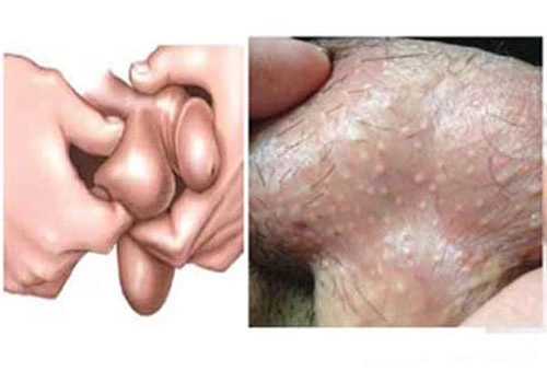 Hình Ảnh Bộ Phận Sinh Dục Nam Giới: Cấu Trúc Chi Tiết, Chức Năng & Thông Tin Y Khoa Dành Cho Người Truy Cập Hình Ảnh Bộ Phận Sinh Dục Nam Giới: Cấu Trúc Chi Tiết, Chức Năng & Thông Tin Y Khoa Dành Cho Người Truy Cập