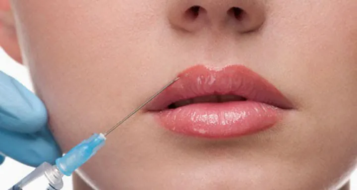 Xem Hình Ảnh Bơm Môi Thực Tế Và Rủi Ro Kèm Giải Pháp Tiêm Filler Môi Cho Phái Đẹp Xem Hình Ảnh Bơm Môi Thực Tế Và Rủi Ro Kèm Giải Pháp Tiêm Filler Môi Cho Phái Đẹp