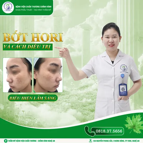 Xem Hình Ảnh Bớt Hori (nevus Hori) Và Phân Biệt Với Nám Má Cho Người Bệnh Xem Hình Ảnh Bớt Hori (nevus Hori) Và Phân Biệt Với Nám Má Cho Người Bệnh