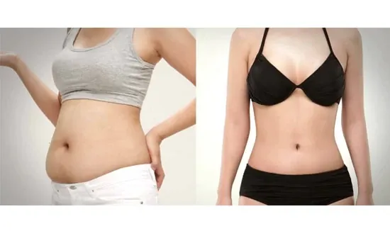 Nhận Diện Các Dạng Hình Ảnh Bụng Mỡ Ở Phái Nữ Và Phân Biệt Với Bụng Bầu Nhận Diện Các Dạng Hình Ảnh Bụng Mỡ Ở Phái Nữ Và Phân Biệt Với Bụng Bầu