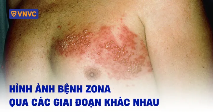 Tải Xuống Bộ Sưu Tập Hình Ảnh Các Hình (hình Học, Thẩm Mỹ) Miễn Phí Cho Nhà Thiết Kế Tải Xuống Bộ Sưu Tập Hình Ảnh Các Hình (hình Học, Thẩm Mỹ) Miễn Phí Cho Nhà Thiết Kế