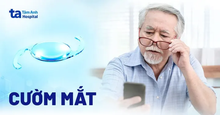 Xem Hình Ảnh Và Dấu Hiệu Nhận Biết Cườm Mắt Cho Người Bệnh: Phân Biệt Cườm Khô Và Cườm Nước Xem Hình Ảnh Và Dấu Hiệu Nhận Biết Cườm Mắt Cho Người Bệnh: Phân Biệt Cườm Khô Và Cườm Nước