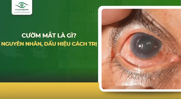 Xem Hình Ảnh Và Dấu Hiệu Nhận Biết Cườm Mắt Cho Người Bệnh: Phân Biệt Cườm Khô Và Cườm Nước Xem Hình Ảnh Và Dấu Hiệu Nhận Biết Cườm Mắt Cho Người Bệnh: Phân Biệt Cườm Khô Và Cườm Nước