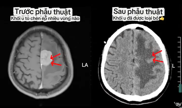 Xem Hình Ảnh Đại Não: Cấu Tạo, Vị Trí Và Chức Năng Giải Phẫu Cho Người Học Y Xem Hình Ảnh Đại Não: Cấu Tạo, Vị Trí Và Chức Năng Giải Phẫu Cho Người Học Y