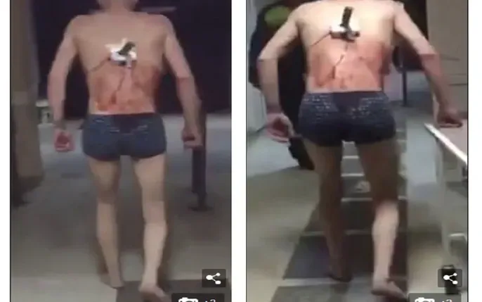 Tổng Hợp Hình Ảnh Đấm Lưng Thư Giãn Cho Người Bị Đau Lưng Và Các Kỹ Thuật Massage Tương Tự Tổng Hợp Hình Ảnh Đấm Lưng Thư Giãn Cho Người Bị Đau Lưng Và Các Kỹ Thuật Massage Tương Tự