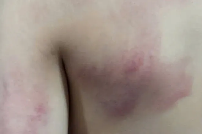 Tổng Hợp Hình Ảnh Đấm Lưng Thư Giãn Cho Người Bị Đau Lưng Và Các Kỹ Thuật Massage Tương Tự Tổng Hợp Hình Ảnh Đấm Lưng Thư Giãn Cho Người Bị Đau Lưng Và Các Kỹ Thuật Massage Tương Tự