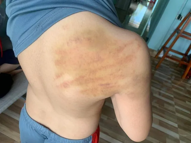 Tổng Hợp Hình Ảnh Đấm Lưng Thư Giãn Cho Người Bị Đau Lưng Và Các Kỹ Thuật Massage Tương Tự Tổng Hợp Hình Ảnh Đấm Lưng Thư Giãn Cho Người Bị Đau Lưng Và Các Kỹ Thuật Massage Tương Tự
