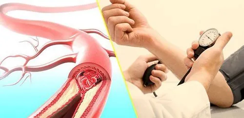 Hướng Dẫn Giải Mã Ý Nghĩa Chỉ Số Hình Ảnh Huyết Áp (biểu Đồ Huyết Áp) Cho Người Dùng Hướng Dẫn Giải Mã Ý Nghĩa Chỉ Số Hình Ảnh Huyết Áp (biểu Đồ Huyết Áp) Cho Người Dùng