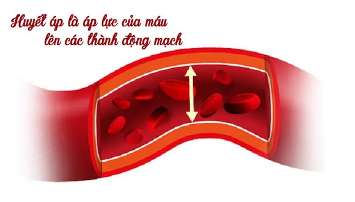 Hướng Dẫn Giải Mã Ý Nghĩa Chỉ Số Hình Ảnh Huyết Áp (biểu Đồ Huyết Áp) Cho Người Dùng Hướng Dẫn Giải Mã Ý Nghĩa Chỉ Số Hình Ảnh Huyết Áp (biểu Đồ Huyết Áp) Cho Người Dùng