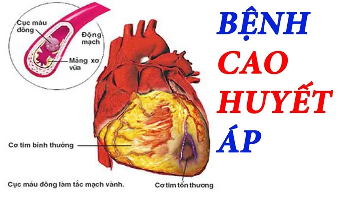 Hướng Dẫn Giải Mã Ý Nghĩa Chỉ Số Hình Ảnh Huyết Áp (biểu Đồ Huyết Áp) Cho Người Dùng Hướng Dẫn Giải Mã Ý Nghĩa Chỉ Số Hình Ảnh Huyết Áp (biểu Đồ Huyết Áp) Cho Người Dùng