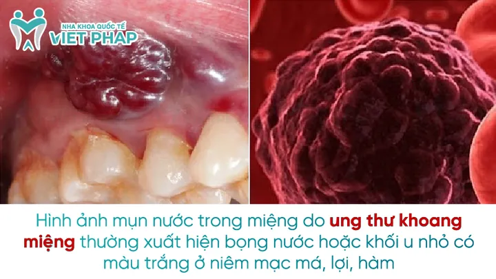 Tổng Hợp Hình Ảnh Khâu Miệng Chất Lượng: Từ Vector Png Đến Meme Giữ Kín Miệng Cho Nhà Thiết Kế Tổng Hợp Hình Ảnh Khâu Miệng Chất Lượng: Từ Vector Png Đến Meme Giữ Kín Miệng Cho Nhà Thiết Kế
