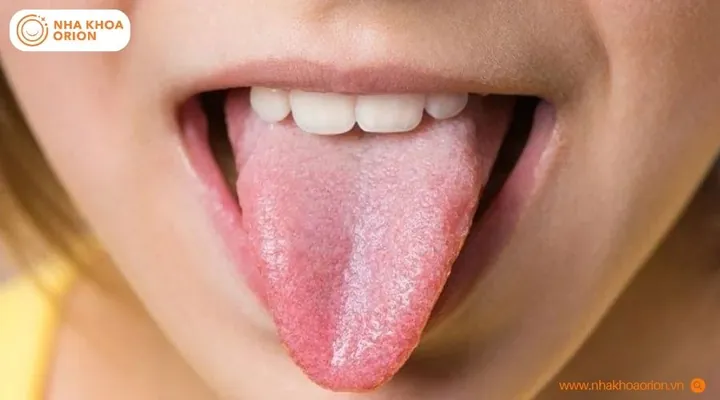 Tải Xuống Hình Ảnh Khỏe Mạnh Miễn Phí Bản Quyền Cho Nhà Thiết Kế: Tổng Hợp Ảnh Sức Khỏe Và Lối Sống Lành Mạnh