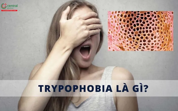 Khám Phá Hình Ảnh Lo Sợ Và Hội Chứng Ám Ảnh Sợ Hãi: Triệu Chứng, Nguyên Nhân, Điều Trị Cho Người Bệnh