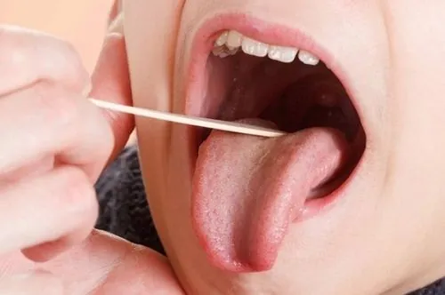 Xem Hình Ảnh Lưỡi Người Bình Thường Và Bệnh Lý Cho Mọi Người Để Nhận Diện Xem Hình Ảnh Lưỡi Người Bình Thường Và Bệnh Lý Cho Mọi Người Để Nhận Diện