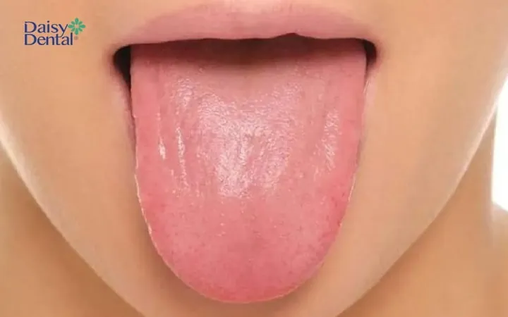 Xem Hình Ảnh Lưỡi Người Bình Thường Và Bệnh Lý Cho Mọi Người Để Nhận Diện Xem Hình Ảnh Lưỡi Người Bình Thường Và Bệnh Lý Cho Mọi Người Để Nhận Diện