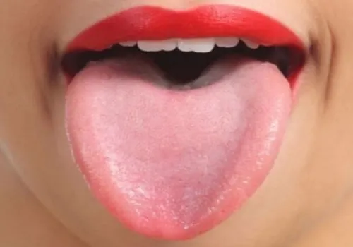 Xem Hình Ảnh Lưỡi Người Bình Thường Và Bệnh Lý Cho Mọi Người Để Nhận Diện Xem Hình Ảnh Lưỡi Người Bình Thường Và Bệnh Lý Cho Mọi Người Để Nhận Diện