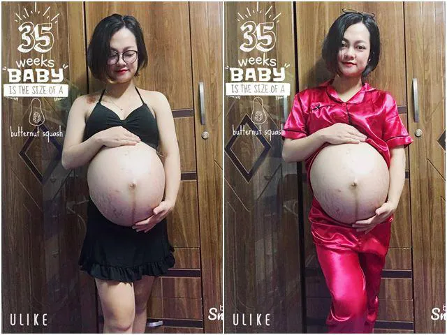 Khám Phá Hình Ảnh Mang Bầu Thực Tế Thay Đổi: Từ Bụng Bầu Đến Thai Nhi Cho Mẹ Bầu Khám Phá Hình Ảnh Mang Bầu Thực Tế Thay Đổi: Từ Bụng Bầu Đến Thai Nhi Cho Mẹ Bầu