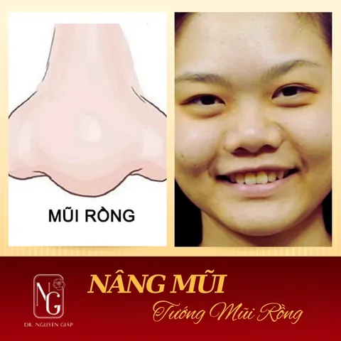 Xem Hình Ảnh Mũi Rồng: Đặc Điểm Và Ý Nghĩa Tướng Số Cho Nam Giới So Với Các Dáng Mũi Phong Thủy