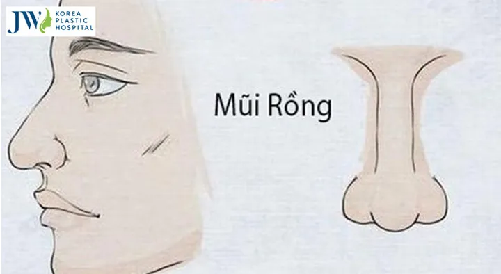 Xem Hình Ảnh Mũi Rồng: Đặc Điểm Và Ý Nghĩa Tướng Số Cho Nam Giới So Với Các Dáng Mũi Phong Thủy