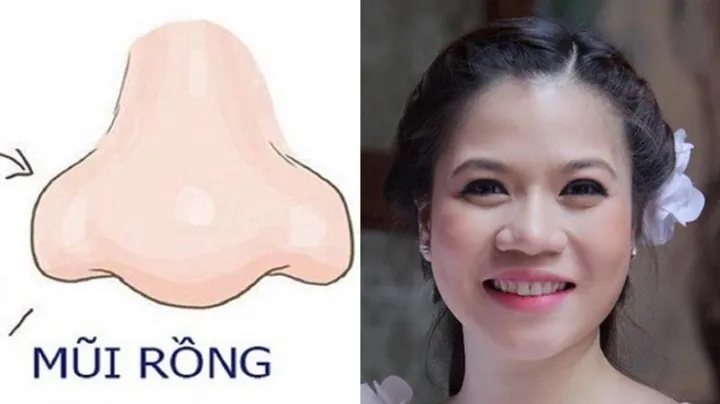 Xem Hình Ảnh Mũi Rồng: Đặc Điểm Và Ý Nghĩa Tướng Số Cho Nam Giới So Với Các Dáng Mũi Phong Thủy