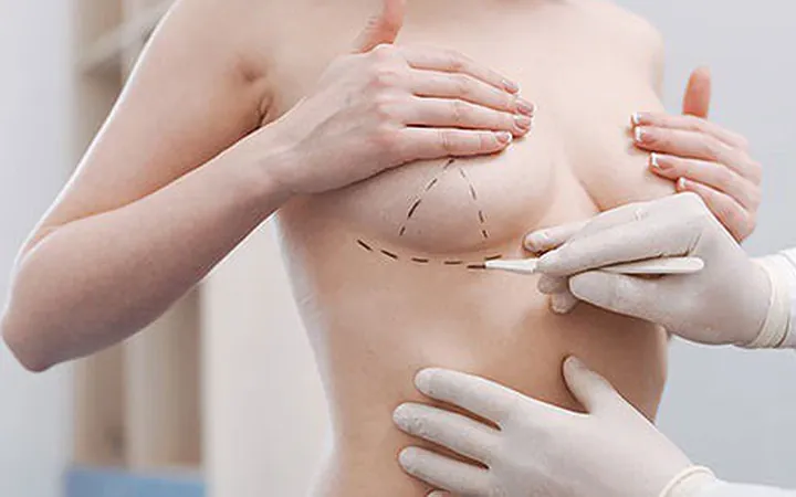 Xem Hình Ảnh Thực Tế Nâng Ngực Của Chị Em Trước Sau Phẫu Thuật