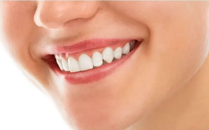 Xem Hình Ảnh Nẹp Răng Trước Và Sau Thực Tế Cho Người Đang Tìm Hiểu Xem Hình Ảnh Nẹp Răng Trước Và Sau Thực Tế Cho Người Đang Tìm Hiểu