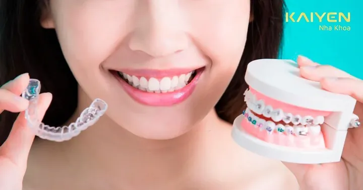 Xem Hình Ảnh Nẹp Răng Trước Và Sau Thực Tế Cho Người Đang Tìm Hiểu Xem Hình Ảnh Nẹp Răng Trước Và Sau Thực Tế Cho Người Đang Tìm Hiểu