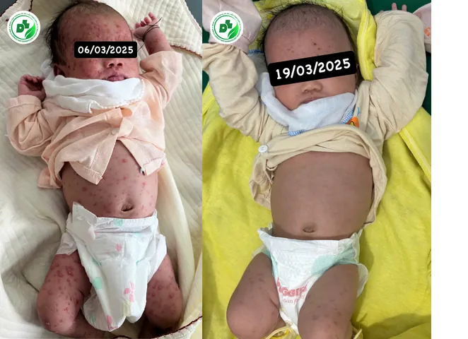 Tổng Hợp Hình Ảnh Neu (đại Học Kinh Tế Quốc Dân) Cho Sinh Viên Và Cựu Sinh Viên: Từ Logo, Cơ Sở Vật Chất Đến Bộ Nhận Diện Thương Hiệu Tổng Hợp Hình Ảnh Neu (đại Học Kinh Tế Quốc Dân) Cho Sinh Viên Và Cựu Sinh Viên: Từ Logo, Cơ Sở Vật Chất Đến Bộ Nhận Diện Thương Hiệu