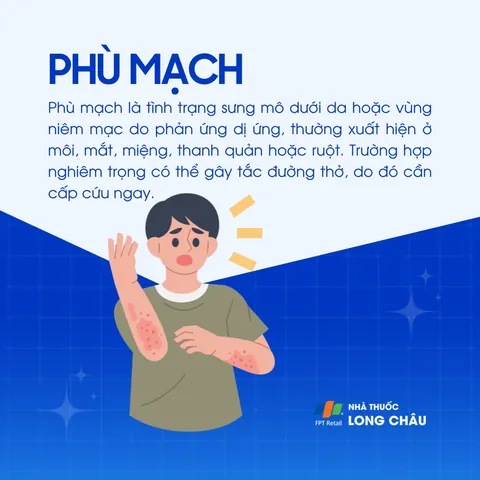 Xem Hình Ảnh Phù Mạch Và Nhận Diện Dấu Hiệu Trực Quan Cho Người Bệnh: Phân Biệt Với Mày Đay Xem Hình Ảnh Phù Mạch Và Nhận Diện Dấu Hiệu Trực Quan Cho Người Bệnh: Phân Biệt Với Mày Đay
