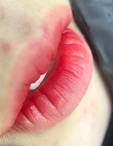 Tổng Hợp Hình Ảnh Phun Môi Thực Tế: Từ Môi Đẹp Tự Nhiên Đến Môi Hỏng Cho Nam Và Nữ