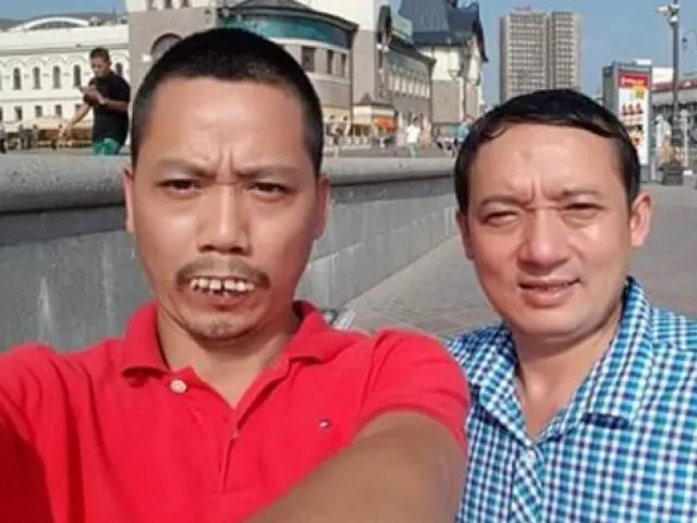 Xem Hình Ảnh Răng Vổ Và Các Loại Răng Vẩu Thường Gặp Ở Người Lớn Để Nhận Biết Đúng Tình Trạng