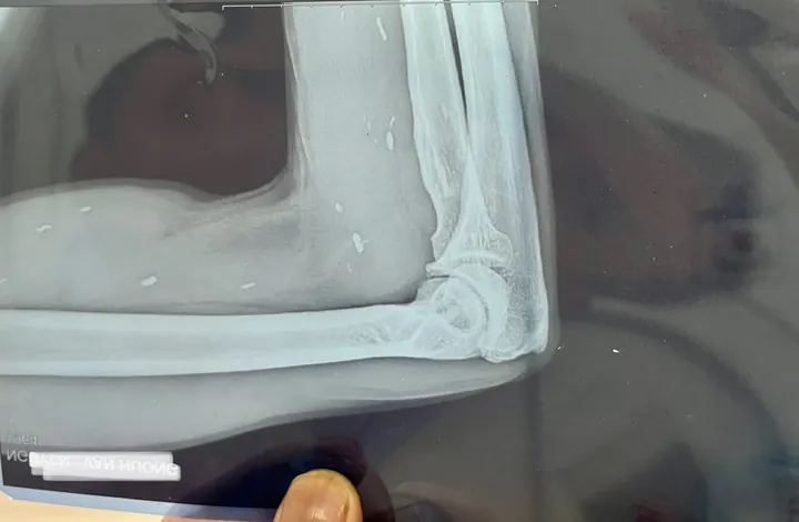 Xem Hình Ảnh Sán Não: Cách Nhận Biết Trên Ct, Mri Và Phân Biệt Với Tổn Thương Khác Cho Người Bệnh