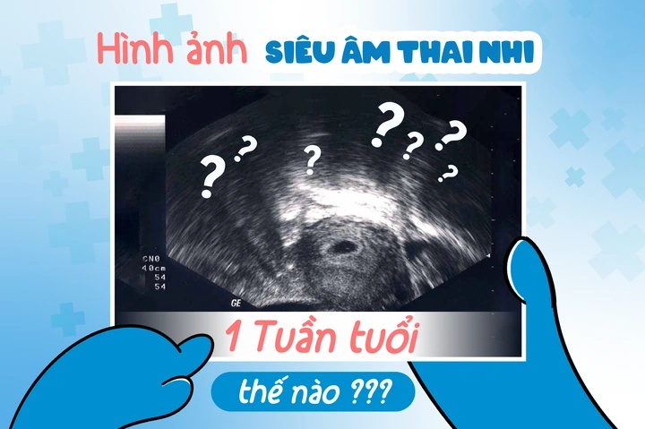 Hình Ảnh Siêu Âm Thai Mới Vào Tử Cung: Khi Nào Và Như Thế Nào Để Nhìn Thấy Phôi Thai? (dành Cho Mẹ Bầu Mới Mang Thai)