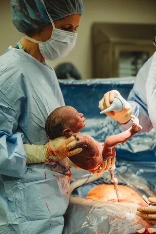 Xem Hình Ảnh Sinh Mổ Thực Tế: Quy Trình Mổ Lấy Thai & Vết Sẹo Cho Mẹ Bầu Xem Hình Ảnh Sinh Mổ Thực Tế: Quy Trình Mổ Lấy Thai & Vết Sẹo Cho Mẹ Bầu