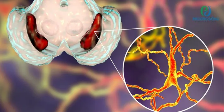 Xem Hình Ảnh Teo Da: Nguyên Nhân, Triệu Chứng Và Cách Điều Trị Cho Người Nghi Ngờ Da Mỏng Do Corticoid Xem Hình Ảnh Teo Da: Nguyên Nhân, Triệu Chứng Và Cách Điều Trị Cho Người Nghi Ngờ Da Mỏng Do Corticoid