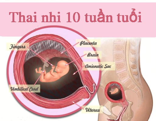 Hình Ảnh Thai Nhi 10 Tuần Trong Bụng Mẹ: Đánh Giá Sự Phát Triển, Dấu Hiệu Khỏe Mạnh & Cách Kiểm Tra Đúng Cách Cho Mẹ Bầu