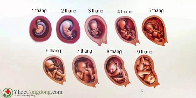 Hình Ảnh Thai Nhi 10 Tuần Trong Bụng Mẹ: Đánh Giá Sự Phát Triển, Dấu Hiệu Khỏe Mạnh & Cách Kiểm Tra Đúng Cách Cho Mẹ Bầu