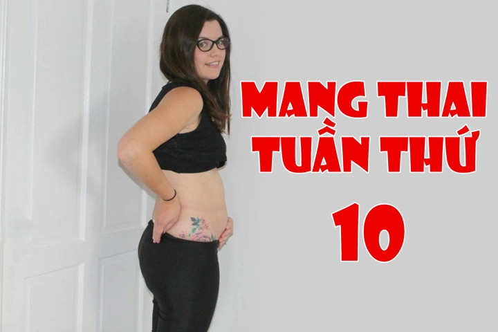Hình Ảnh Thai Nhi 10 Tuần Trong Bụng Mẹ: Đánh Giá Sự Phát Triển, Dấu Hiệu Khỏe Mạnh & Cách Kiểm Tra Đúng Cách Cho Mẹ Bầu